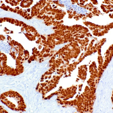 PAX-8 Rabbit Monoclonal Antibody(ARM863)