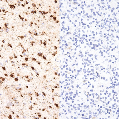 IDH1 R132H Mouse Monoclonal Antibody(ARM873)