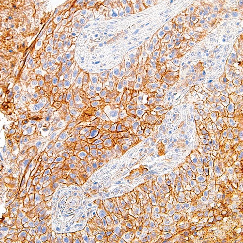 PD-L1 Rabbit Monoclonal Antibody(ARM880)