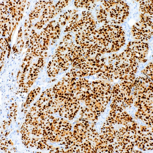 Estrogen Receptor Rabbit Monoclonal Antibody(ARM883)