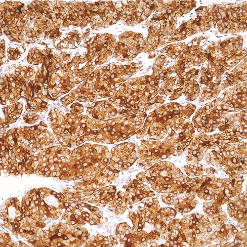 Calcitonin Rabbit Monoclonal Antibody(ARM884)