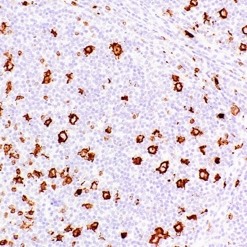 CD15/Leu-M1 Mouse Monoclonal Antibody(ARM887)