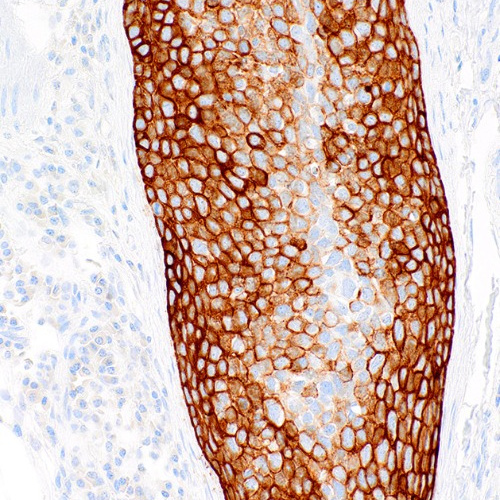Cytokeratin 5/6 Mouse Monoclonal Antibody(ARM890)