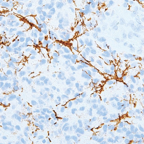 Nerve Growth Factor Receptor (NGFR) Mouse Monoclonal Antibody(ARM894)