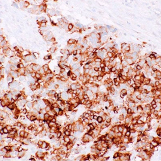 Synaptophysin Mouse Monoclonal Antibody(ARM896)