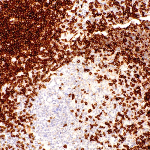 CD5 Rabbit Monoclonal Antibody(ARM897)