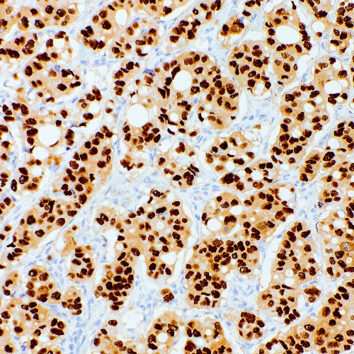 Progesterone Receptor Mouse Monoclonal Antibody(ARM898)