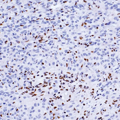 BAP1 Mouse Monoclonal Antibody(ARM899)