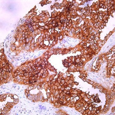 FOLR1 Mouse Monoclonal Antibody(ARM900)