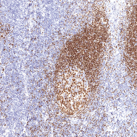 PAX-5(BSAP) Mouse Monoclonal Antibody(ARM901)