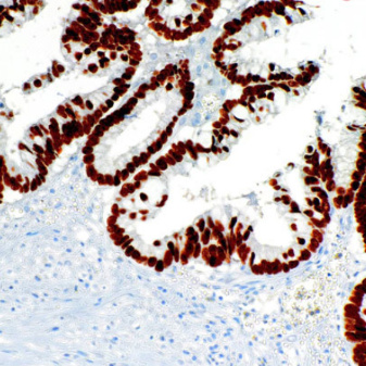 FOXA1 Mouse Monoclonal Antibody(ARM906)