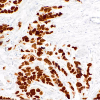 FOXP1 Mouse Monoclonal Antibody(ARM907)