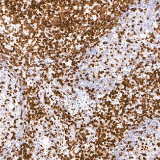 ZAP-70 Mouse Monoclonal Antibody(ARM909)