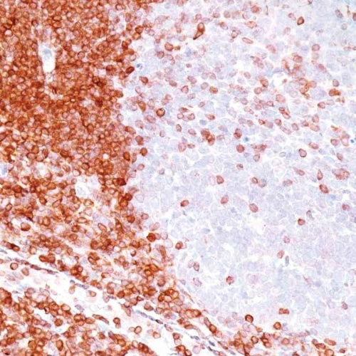 BCL-2 Mouse Monoclonal Antibody(ARM910)