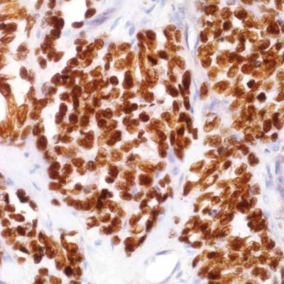 MyoD1 Mouse Monoclonal Antibody(ARM911)
