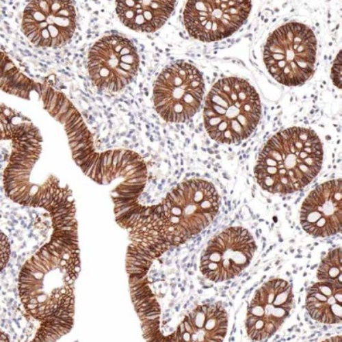EpCAM Mouse Monoclonal Antibody(ARM912)