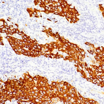 CK34Beta E12 Mouse Monoclonal Antibody(ARM913)