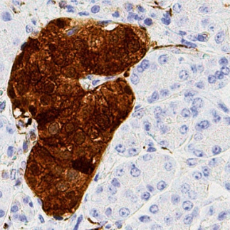 NSE Mouse Monoclonal Antibody(ARM914)
