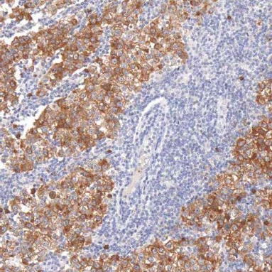 Podoplanin Mouse Monoclonal Antibody(ARM915)