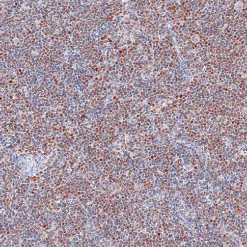 SOX11 Mouse Monoclonal Antibody(ARM916)