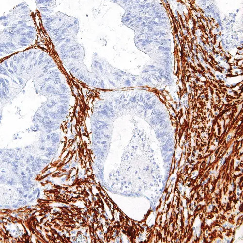 Actin, Smooth Muscle Mouse Monoclonal Antibody(ARM919)