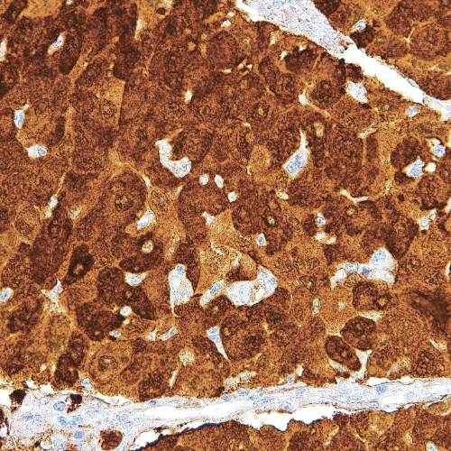 AKR1B10 Mouse Monoclonal Antibody(ARM920)