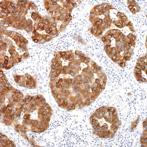 ALK Mouse Monoclonal Antibody(ARM921)