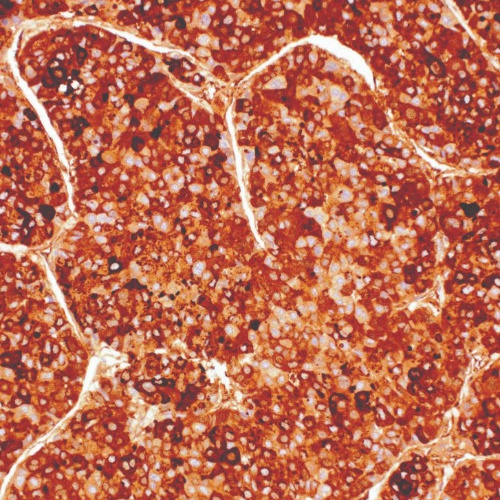 Alpha-Fetoprotein Mouse Monoclonal Antibody(ARM922)