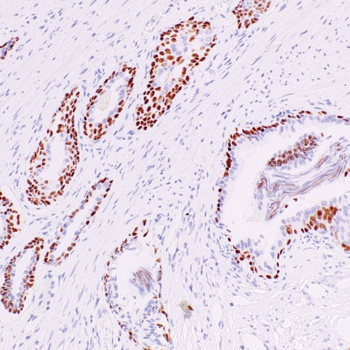 Androgen Receptor Rabbit Monoclonal Antibody(ARM923)