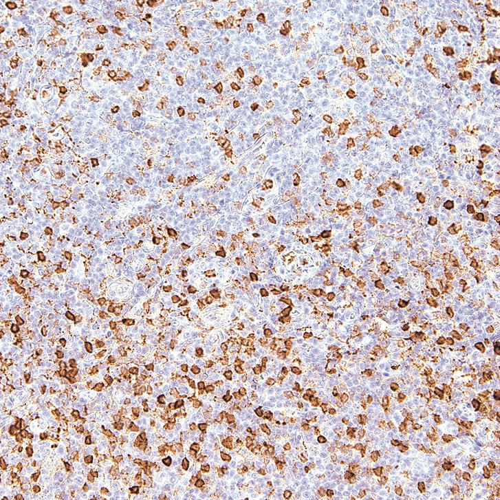 Annexin A1 Mouse Monoclonal Antibody(ARM924)