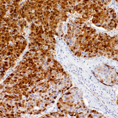 Arginase-1 (ARG1) Rabbit Monoclonal Antibody(ARM925)