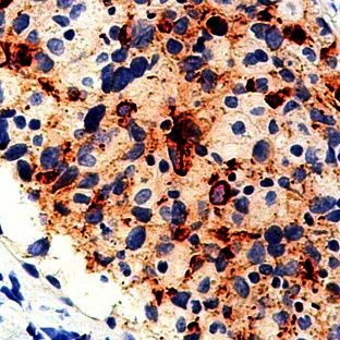 BCA-225 Mouse Monoclonal Antibody(ARM926)