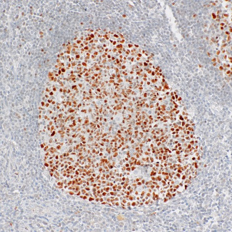 BCL6 Mouse Monoclonal Antibody(ARM927)