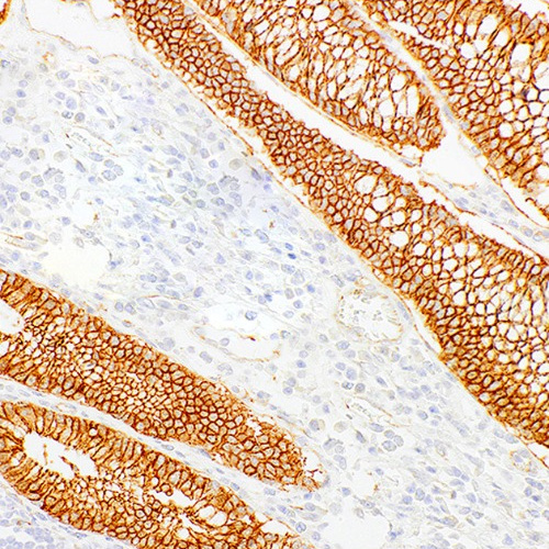 Beta-Catenin Mouse Monoclonal Antibody(ARM928)