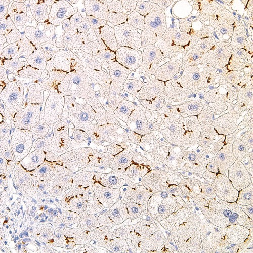 BSEP Mouse Monoclonal Antibody(ARM930)