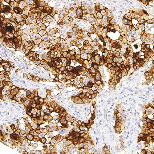 CA-125 Mouse Monoclonal Antibody(ARM931)