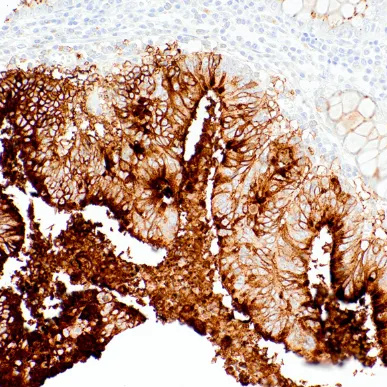 CA19-9 Mouse Monoclonal Antibody(ARM932)