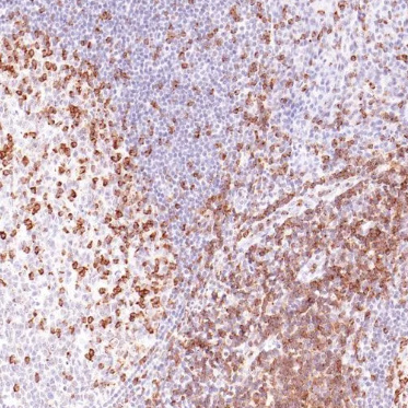 Cadherin-17 Rabbit Monoclonal Antibody(ARM933)