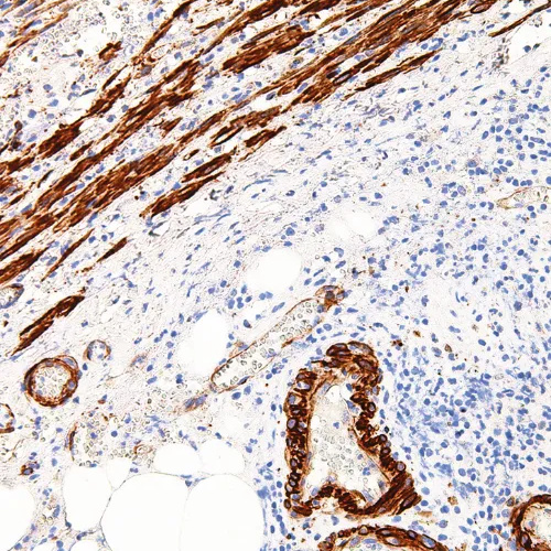 Caldesmon Mouse Monoclonal Antibody(ARM934)