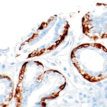 Calponin Mouse Monoclonal Antibody(ARM935)