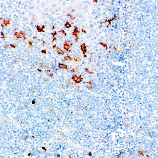 CD16 Rabbit Monoclonal Antibody(ARM938)