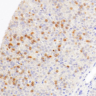 CD1a Mouse Monoclonal Antibody(ARM940)
