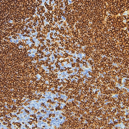 CD20 Mouse Monoclonal Antibody(ARM942)