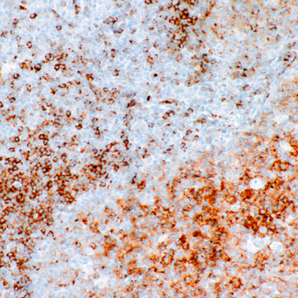 CD22 Rabbit Monoclonal Antibody(ARM943)