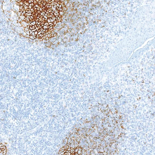 CD23 Rabbit Monoclonal Antibody(ARM944)