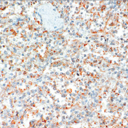 CD25 Rabbit Monoclonal Antibody(ARM945)