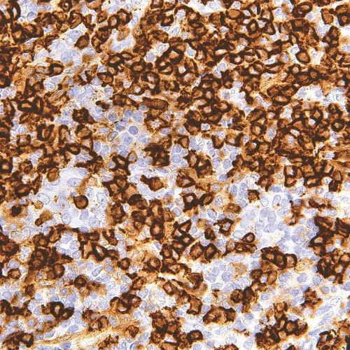 CD45RA Mouse Monoclonal Antibody(ARM952)
