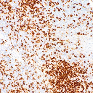 CD45RO Mouse Monoclonal Antibody(ARM953)