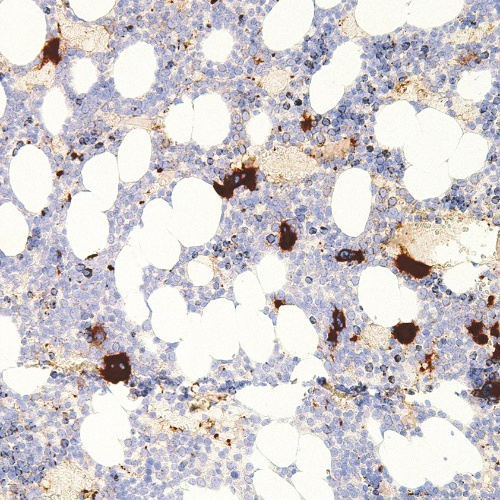 CD61 Mouse Monoclonal Antibody(ARM955)