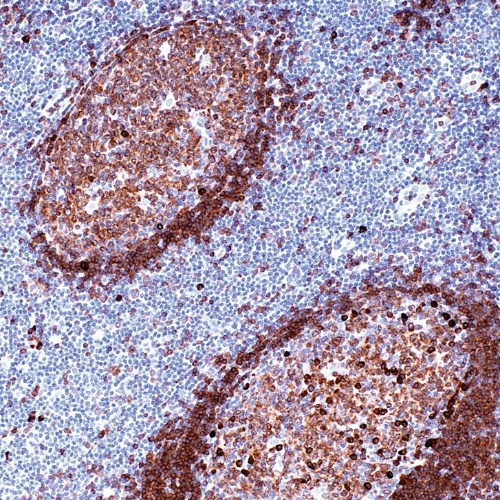CD79a Rabbit Monoclonal Antibody(ARM960)